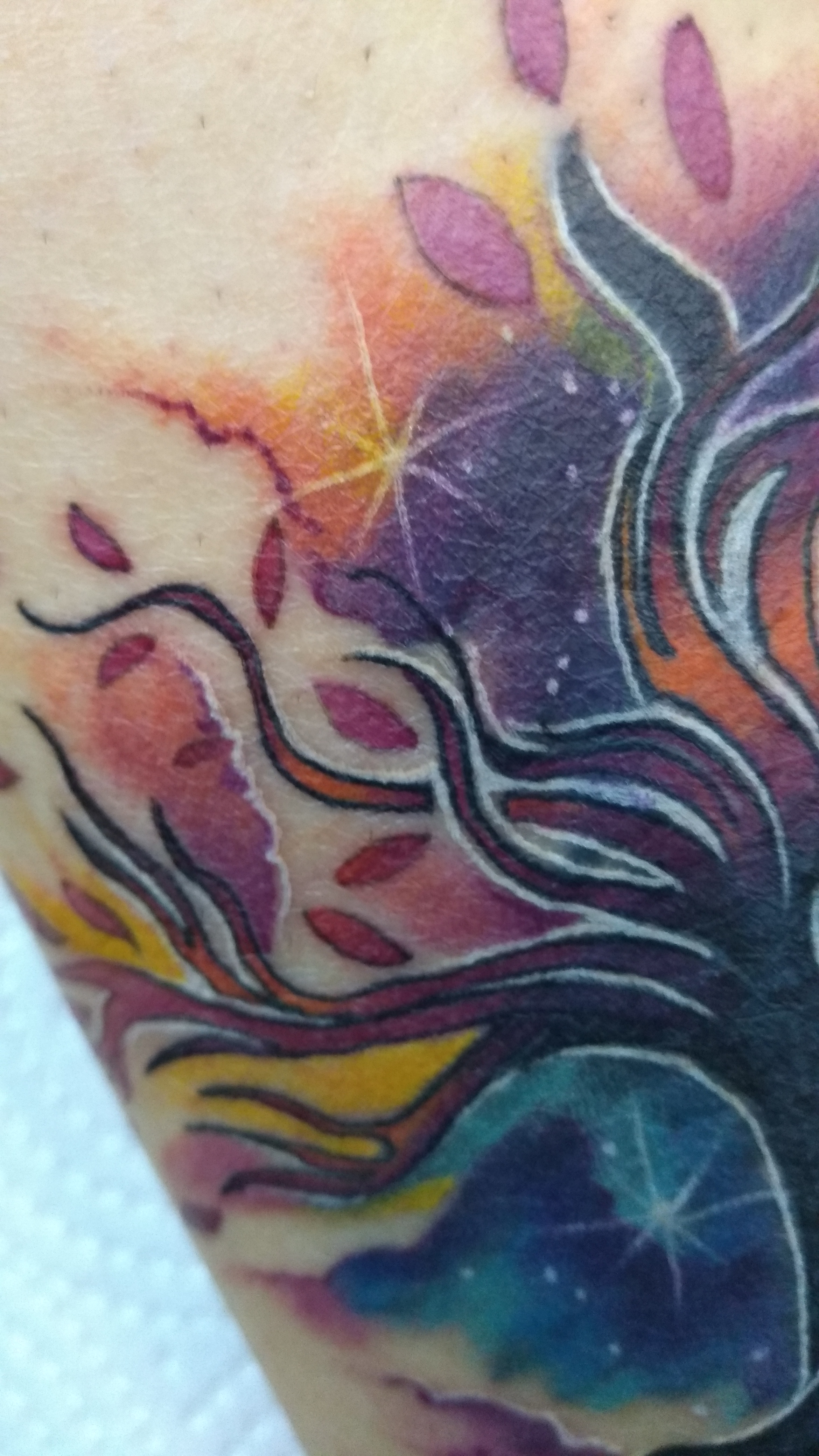 Resultado do cover up — ângulo lateral